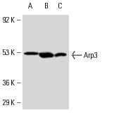 Arp3 (H-110): sc-15390. Western blot analysis of Arp3 expression in HeLa (A), KNRK (B) and NIH/3T3 (C) whole cell lysates.