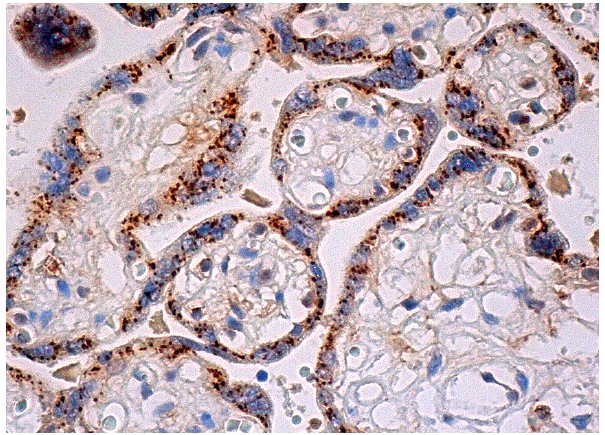 Gl Syn (C-20): sc-6640. Immunoperoxidase staining of formalin fixed, paraffin-embedded human placenta tissue showing cytoplasmic staining of trophoblastic cells.