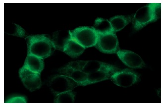 p-Adducin (Ser 662)-R: sc-12614-R. Immunofluorescence staining of methanol-fixed NIH/3T3 cells showing cytoskeletal localization.