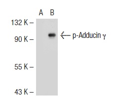 p-Adducin (Ser 662): sc-12614. Western blot analysis of Adducin γ phosphorylation in non-transfected: sc-117752 (A) and mouse Adducin γ transfected: sc-118249 (B) 293T whole cell lysates.