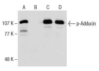 Western blot analysis of Adducin phosphorylation in untreated (A,C) and lambda protein phosphatase (sc-200312A) treated (B,D) HL-60 whole cell lysates. Antibodies tested include p-Adducin (Ser 662)-R: sc-12614-R (A,B) and Adducin α (H-100): sc-25731 (C,D).