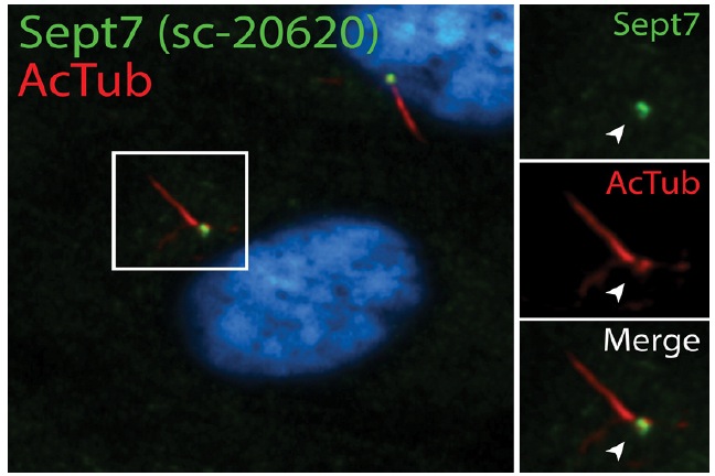 Septin 7 (H-120): sc-20620. Double immunofluorescent staining of methanol fixed human retinal pigment epithelial (RPE) cells using acetylated α Tubulin (6-11B-1): sc-23950 and donkey anti-mouse IgG-CFL 555: sc-362268 showing cilia staining (red immunofluorescence), Septin 7 (H-120): sc-20620 and donkey anti-rabbit IgG-FITC: sc-2090 showing base of cilia staining (green immunofluorescence) and Hoechst 33342: sc-391054 nuclear counterstain (blue immunofluorescence). Image kindly provided by Moshe Kim, Department of Cell Biology, Hospital for Sick Children (Toronto, Canada)