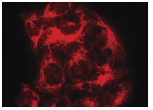 acetylated α Tubulin (6-11B-1): sc-23950. Immunofluorescence staining of methanol-fixed HeLa cells showing cytoplasmic localization.