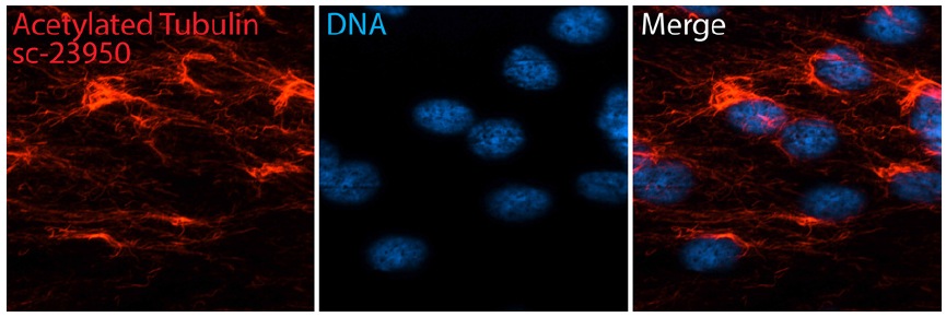 acetylated α Tubulin (6-11B-1): sc-23950. Immunofluorescent staining of methanol fixed human retinal pigment epithelial (RPE) cells showing microtubule-like staining (red immunofluorescence) and Hoechst 33342: sc-391054 nuclear counterstain (blue immunofluorescence). Secondary antibody used was donkey anti-mouse IgG-CFL 555: sc-362268 . Image kindly provided by Moshe Kim, Department of Cell Biology, Hospital for Sick Children (Toronto, Canada)