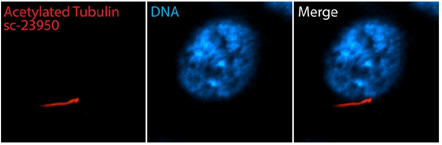 acetylated α Tubulin (6-11B-1): sc-23950. Immunofluorescent staining of methanol fixed, serum-starved human retinal pigment epithelial (RPE) cells showing cilia staining (red immunofluorescence) and Hoechst 33342: sc-391054 nuclear counterstain (blue immunofluorescence). Secondary antibody used was donkey anti-mouse IgG-CFL 555: sc-362268 . Image kindly provided by Moshe Kim, Department of Cell Biology, Hospital for Sick Children (Toronto, Canada)