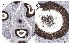 Ankyrin G (H-215): sc-28561. Immunoperoxidase staining of formalin fixed, paraffin-embedded human epididymus tissue showing cytoplasmic, membrane, and nuclear staining of glandular cells at low (A) and high (B) magnification. Kindly provided by The Swedish Human Protein Atlas (HPA) program.