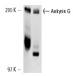 Ankyrin G (H-215): sc-28561. Western blot analysis of Ankyrin G expression in Caco-2 (A) and IMR-32 (B) whole cell lysates.
