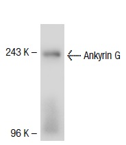 Ankyrin G (H-215): sc-28561. Western blot analysis of Ankyrin G expression in rat brain tissue extract.