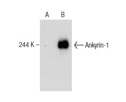 Ankyrin-1 (8C3): sc-12733. Western blot analysis of Ankyrin-1 expression in non-transfected: sc-117752 (A) and human Ankyrin-1 transfected: sc-371924 (B) 293T whole cell lysates.