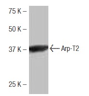Arp-T2 (NB82): sc-130487. Western blot analysis of Arp-T2 expression in Hep G2 whole cell lysate.