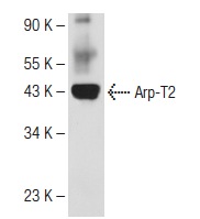 Arp-T2 (NB82): sc-130487. Western blot analysis of Arp-T2 expression in mouse brain tissue extract.