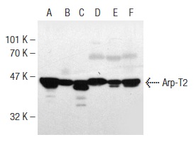 Arp-T2 (NB82): sc-130487. Western blot analysis of Arp-T2 expression in Sol8 (A), F9 (B) and L8 (C) whole cell lysates and rat skeletal muscle (D), rat testis (E) and mouse brain (F) tissue extracts.