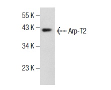 Arp-T2 (NB82): sc-130487. Western blot analysis of Arp-T2 expression in T98G whole cell lysate.