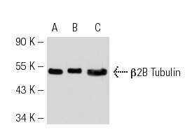 βTubulin (3F3-G2): sc-53140. Western blot analysis of β2B Tubulin expression in non-transfected 293T: sc-117752 (A), human β2B Tubulin transfected 293T: sc-158195 (B) and K-562 (C) whole cell lysates.