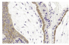 Homer (D-3): sc-17842. Immunoperoxidase staining of formalin fixed, paraffin-embedded human placenta tissue showing membrane and cytoplasmic staining of trophoblastic and decidual cells. Kindly provided by The Swedish Human Protein Atlas (HPA) program.