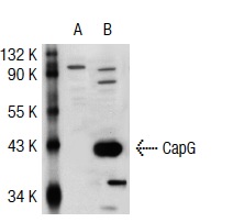 CapG (H-85): sc-66823. Western blot analysis of CapG expression in non-transfected: sc-117752 (A) and mouse CapG transfected: sc-118989 (B) 293T whole cell lysates.