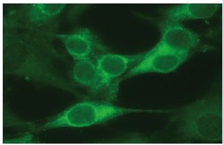 CapG (H-9): sc-166428. Immunofluorescence staining of methanol-fixed NIH/3T3 cells showing cytoplasmic and nuclear localization.