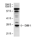 ChM-1 (H-300): sc-33563. Western blot analysis of ChM-1 expression in human PBL whole cell lysate.