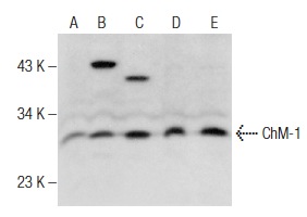 ChM-1 (H-300): sc-33563. Western blot analysis of ChM-1 expression in U-2 OS (A), HOS (B), SW480 (C), HEL 92.1.7 (D) and K-562 (E) whole cell lysates.