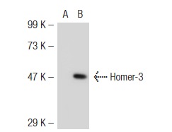Homer (E-18): sc-8921. Western blot analysis of Homer-3 expression in non-transfected: sc-117752 (A) and mouse Homer-3 transfected: sc-120874 (B) 293T whole cell lysates.