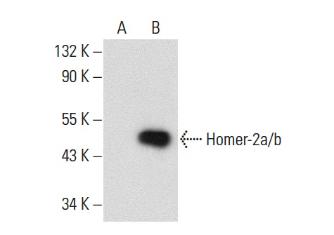 Homer (E-18): sc-8921. Western blot analysis of Homer-2a/b expression in non-transfected: sc-117752 (A) and human Homer-2a/b transfected: sc-176532 (B) 293T whole cell lysates.