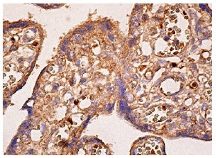 CLIP-170 (F-3): sc-28325. Immunoperoxidase staining of formalin fixed, paraffin-embedded human placenta tissue showing cytoplasmic staining of trophoblastic cells.