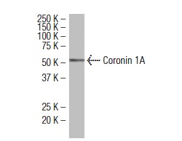 Coronin 1A (14.1): sc-100925. Western blot analysis of Coronin 1A expression in K-562 whole cell lysate.
