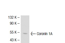 Coronin 1A (14.1): sc-100925. Western blot analysis of Coronin 1A expression in K-562 whole cell lysate.