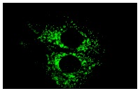 Homer-1b/c (B-5): sc-25271. Immunofluorescence staining of methanol-fixed A-10 cells showing cytoplasmic localization.
