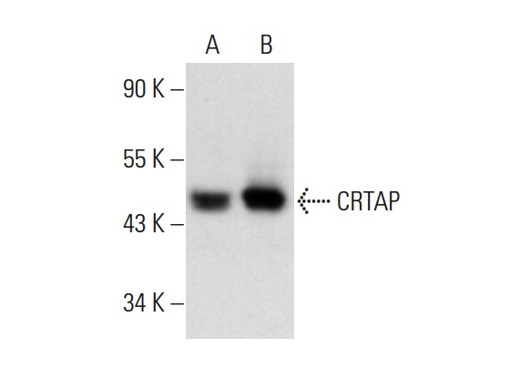 CRTAP (L-24): sc-100920. Western blot analysis of CRTAP expression in non-transfected: sc-117752 (A) and human CRTAP transfected: sc-159963 (B) 293T whole cell lysates.