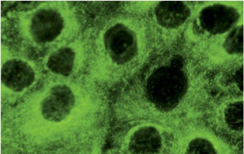 Cytokeratin 5 (RCK103): sc-32721. Immunofluorescence staining of methanol-fixed A-431 cells showing cytoskeletal localization.