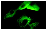 Homer-1b/c (H-174): sc-20807. Immunofluorescence staining of methanol-fixed A-10 cells showing cytoplasmic and membrane localization.