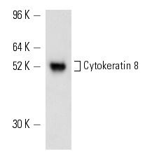Cytokeratin 8 (C51): sc-8020. Western blot analysis of Cytokeratin 8 expression in JEG-3 whole cell lysate.