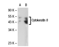 Cytokeratin 8 (Ks8.7): sc-101459. Western blot analysis of Cytokeratin 8 expression in non-transfected: sc-117752 (A) and human Cytokeratin 8 transfected: sc-113509 (B) 293T whole cell lysates.