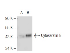 Cytokeratin 8 (Ks8.7): sc-101459. Western blot analysis of Cytokeratin 8 expression in non-transfected: sc-117752 (A) and human Cytokeratin 8 transfected: sc-110493 (B) 293T whole cell lysates.