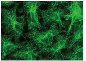 Cytokeratin 8 (Ks8.7): sc-101459. Immunofluorescence staining of methanol-fixed HeLa cells showing cytoskeletal localization.