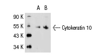Cytokeratin 10 (VIK-10): sc-51581. Western blot analysis of Cytokeratin 10 expression in non-transfected: sc-117752 (A) and human Cytokeratin 10 transfected: sc-113858 (B) 293T whole cell lysates.
