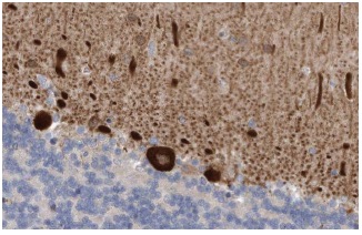 Homer-3 (H-134): sc-28967. Immunoperoxidase staining of formalin fixed, paraffin-embedded human cerebellum tissue showing cytoplasmic staining of cells in cells in molecular layer & Purkinje cells at high magnification. Kindly provided by The Swedish Human Protein Atlas (HPA) program.