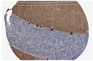 Homer-3 (H-134): sc-28967. Immunoperoxidase staining of formalin fixed, paraffin-embedded human cerebellum tissue showing cytoplasmic staining of cells in cells in molecular layer & Purkinje cells at low magnification. Kindly provided by The Swedish Human Protein Atlas (HPA) program.