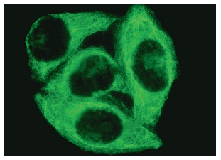 Cytokeratin 18 (DC-10): sc-6259. Immunofluorescence staining of methanol-fixed HeLa cells showing cytoskeletal localization.