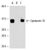Cytokeratin 18 (DC-10): sc-6259. Western blot analysis of Cytokeratin 18 expression in MCF7 (A), C32 (B) and HeLa (C) whole cell lysates.