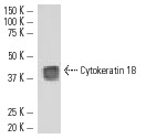 Cytokeratin 18 (DC-10): sc-6259. Western blot analysis of Cytokeratin 18 expression in MCF7 whole cell lysate.