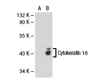 Cytokeratin 18 (DC-10): sc-6259. Western blot analysis of Cytokeratin 18 expression in non-transfected: sc-110760 (A) and human Cytokeratin 18 transfected: sc-112918 (B) 293 whole cell lysates.