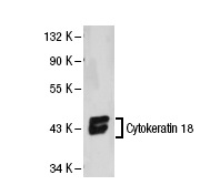 Cytokeratin 18 (DC-10): sc-6259. Western blot analysis of Cytokeratin 18 expression in Hep G2 whole cell lysate.