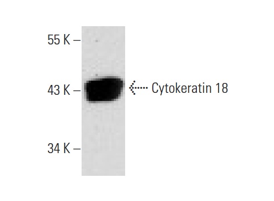 Cytokeratin 18 (DC-10): sc-6259. Western blot analysis of Cytokeratin 18 expression in T24 whole cell lysate.