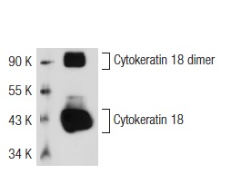 Cytokeratin 18 (DC-10): sc-6259. Western blot analysis of Cytokeratin 18 expression in SK-BR-3 whole cell lysate.