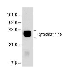 Cytokeratin 18 (DC-10): sc-6259. Western blot analysis of Cytokeratin 18 expression in MCF7 whole cell lysate.