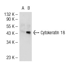 Cytokeratin 18 (DC-10): sc-6259. Western blot analysis of Cytokeratin 18 expression in non-transfected: sc-117752 (A) and human Cytokeratin 18 transfected: sc-174503 (B) 293T whole cell lysates.