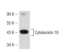 Cytokeratin 18 (N-16): sc-31700. Western blot analysis of Cytokeratin 18 expression in SK-BR-3 whole cell lysate.