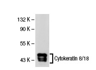 Cytokeratin 8/18 (NCL-5D3): sc-52325. Western blot analysis of Cytokeratin 8/18 expression in Hep G2 whole cell lysate.